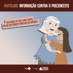 Vitiligo 5